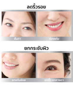 U T LP 003